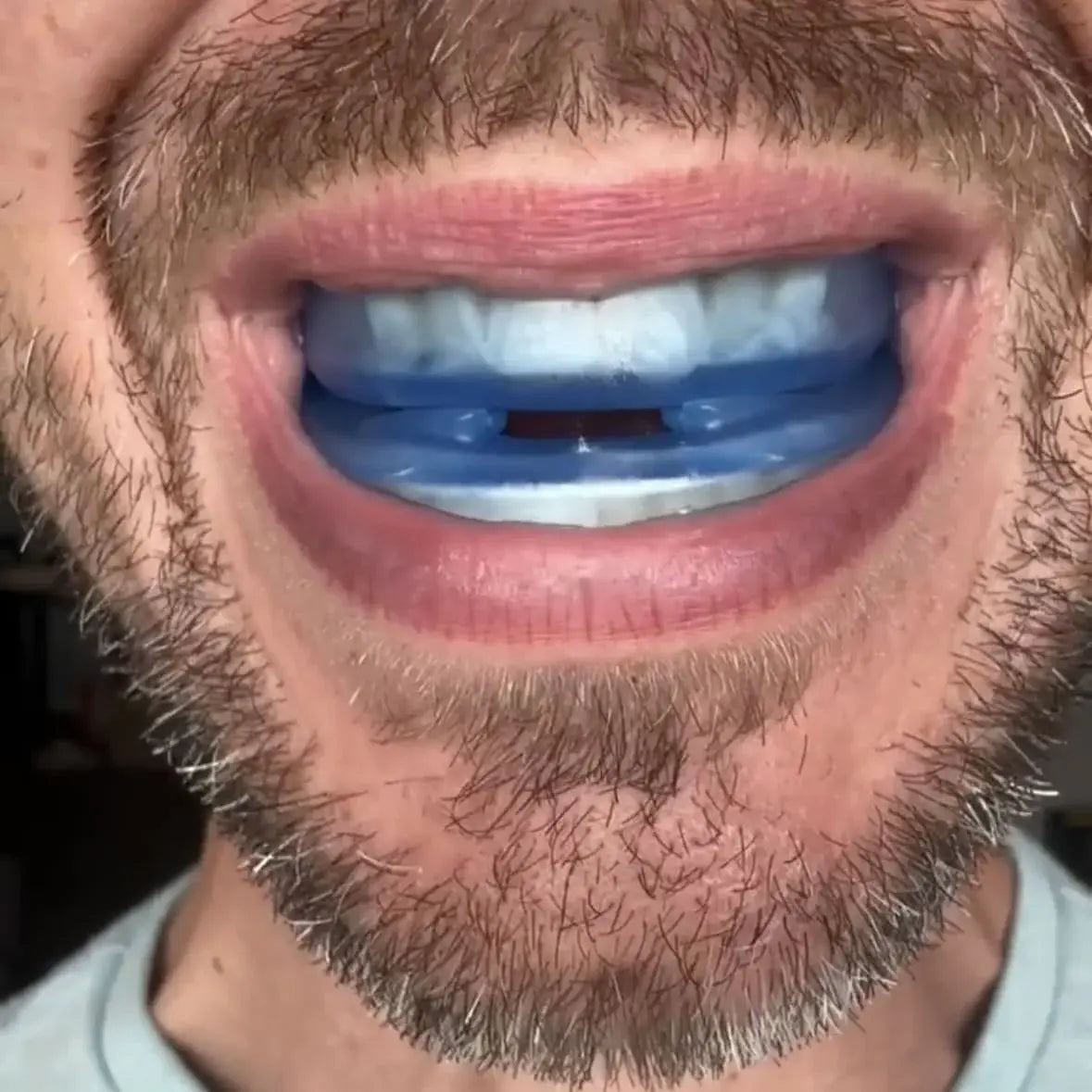 Nuvozen - Embout buccal anti-ronflement ajustable à votre mâchoire | Marque 100% québécoise ♥️